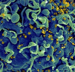 HI-Virus: Wütet schon viel länger als gedacht.