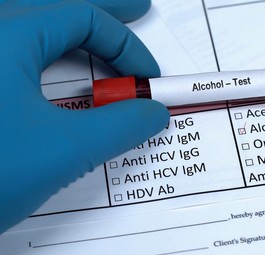 Alkoholtest: Die ausländischen Standorten sollen Daten an die US-Regierung senden.
