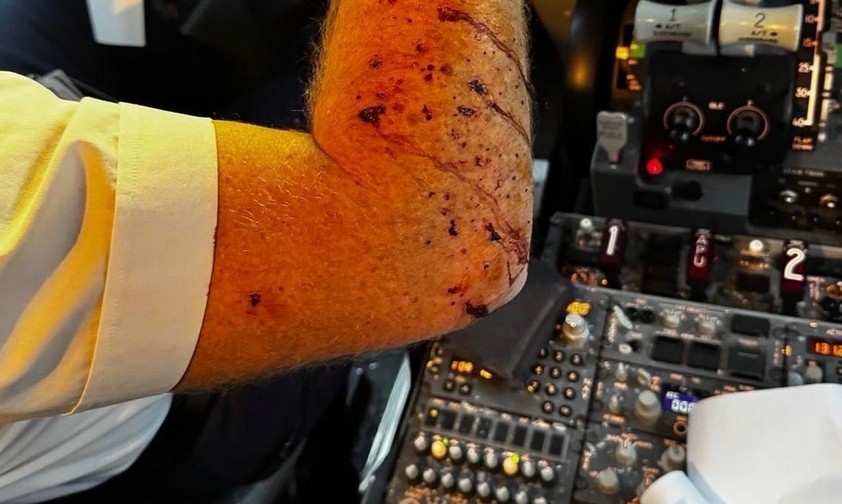 Der verletzte Arm des Piloten: Was ließ die Scheibe zersplittern?