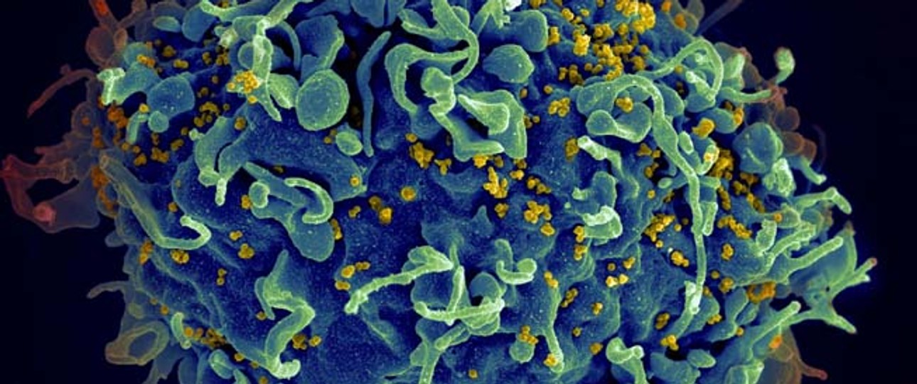 HI-Virus: Wütet schon viel länger als gedacht.