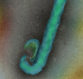 Ebola-Virus: An Bord von Flugzeugen in die USA gereist.