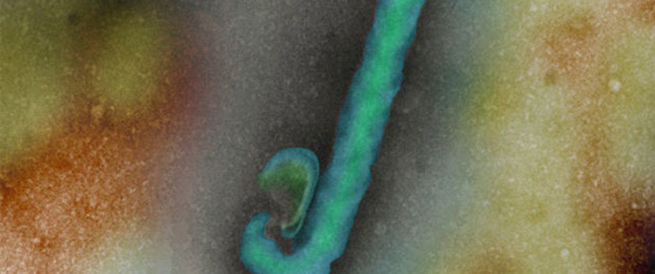 Ebola-Virus: An Bord von Flugzeugen in die USA gereist.