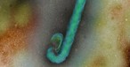 Ebola-Virus: An Bord von Flugzeugen in die USA gereist.