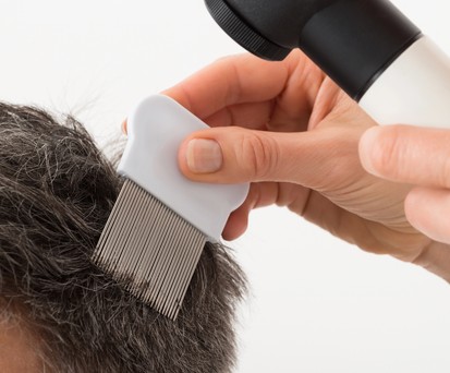 Läusekamm: Die Tiere verbreiten sich nur bei engem Kontakt.