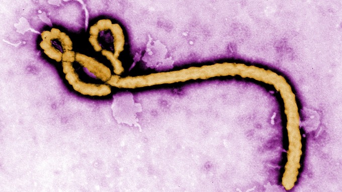 Ebola-Virus: kann tödlich sein.