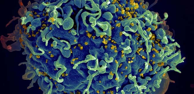 HI-Virus: Wütet schon viel länger als gedacht.