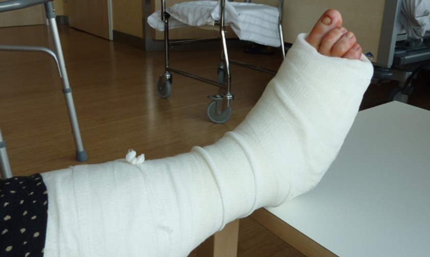 Wer einen Gips trägt, der weniger als vier Tage alt ist, darf bei Air Berlin nicht an Bord. Das Gesundheitsrisiko sei zu groß. Ein Gipsbein muss man zudem vorher anmelden - aus Platzgründen.