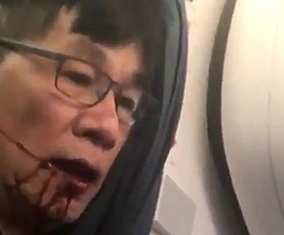 United Airlines entschuldigt sich