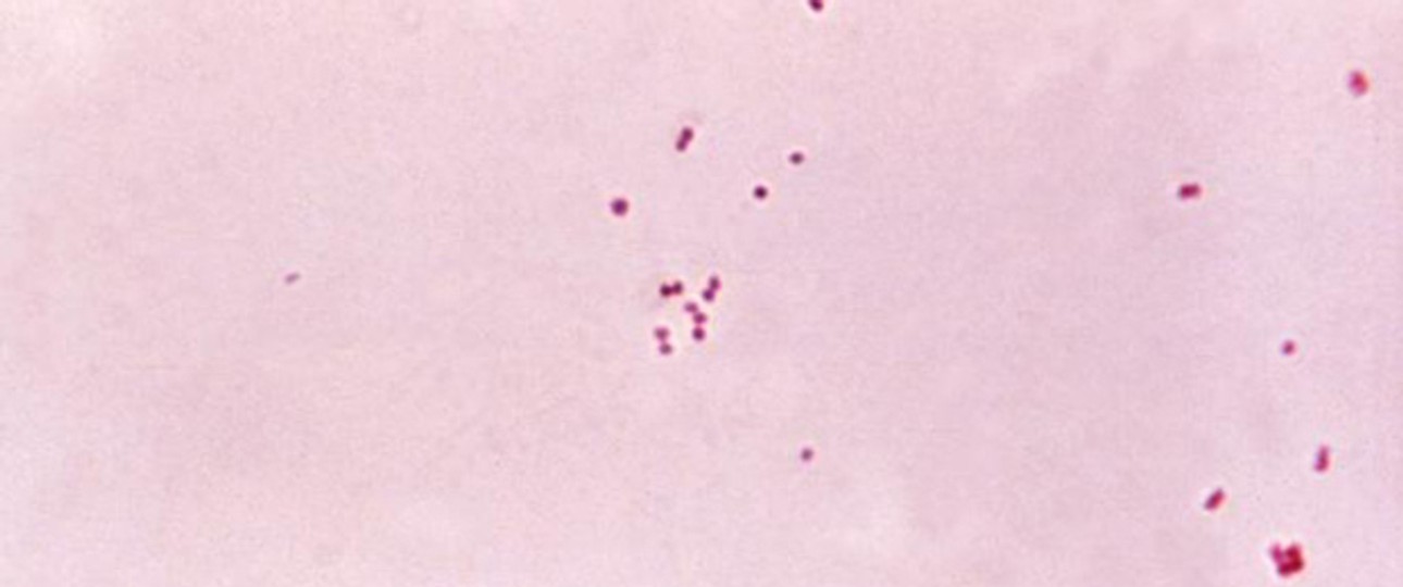 Meningokokken: Häufiger Auslöser der Meningitis.