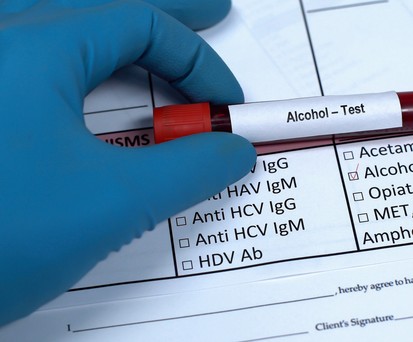 Alkoholtest: Die ausländischen Standorten sollen Daten an die US-Regierung senden.