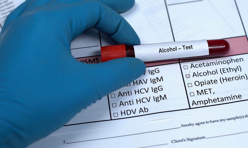 Alkoholtest: Die ausländischen Standorten sollen Daten an die US-Regierung senden.