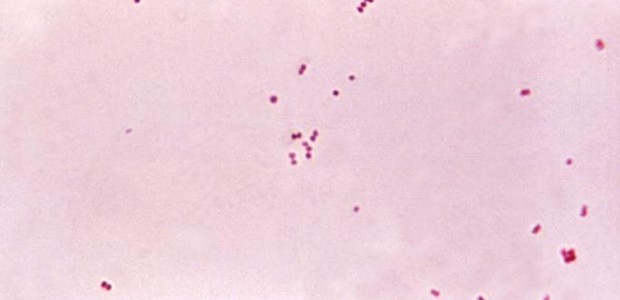 Meningokokken: Häufiger Auslöser der Meningitis.