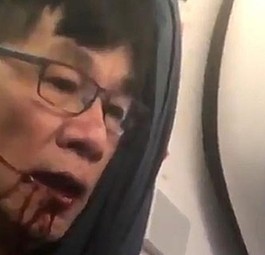 United Airlines entschuldigt sich