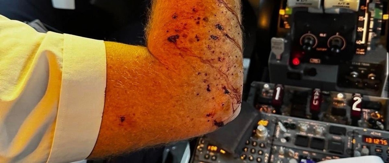 Der verletzte Arm des Piloten: Was ließ die Scheibe zersplittern?