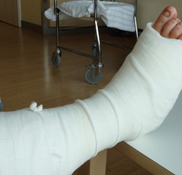 Wer einen Gips trägt, der weniger als vier Tage alt ist, darf bei Air Berlin nicht an Bord. Das Gesundheitsrisiko sei zu groß. Ein Gipsbein muss man zudem vorher anmelden - aus Platzgründen.