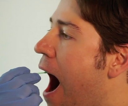 Abstrich: Resultat innerhalb von 30 bis 60 Minuten.