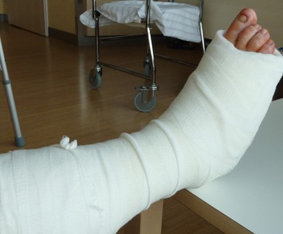 Wer einen Gips trägt, der weniger als vier Tage alt ist, darf bei Air Berlin nicht an Bord. Das Gesundheitsrisiko sei zu groß. Ein Gipsbein muss man zudem vorher anmelden - aus Platzgründen.