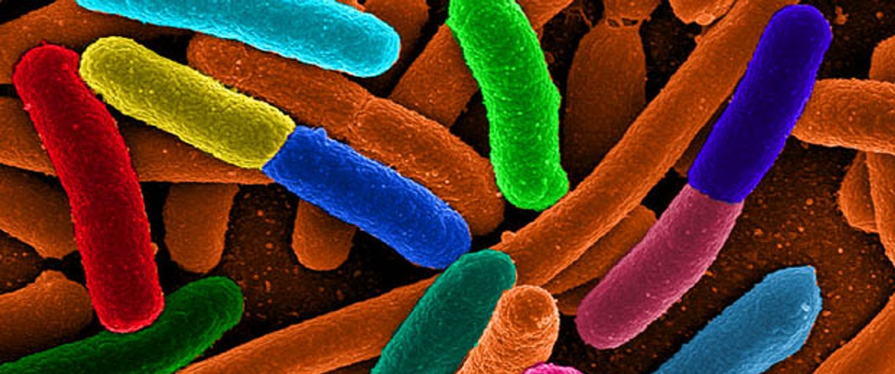 Escherichia coli: Die Bakterien können überall lauern.